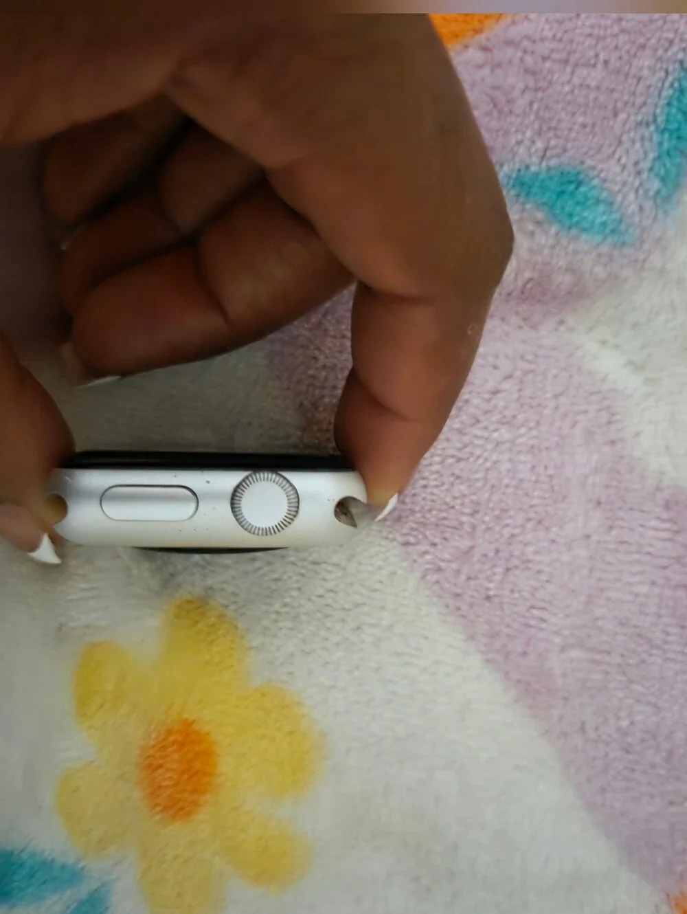 Apple watch series